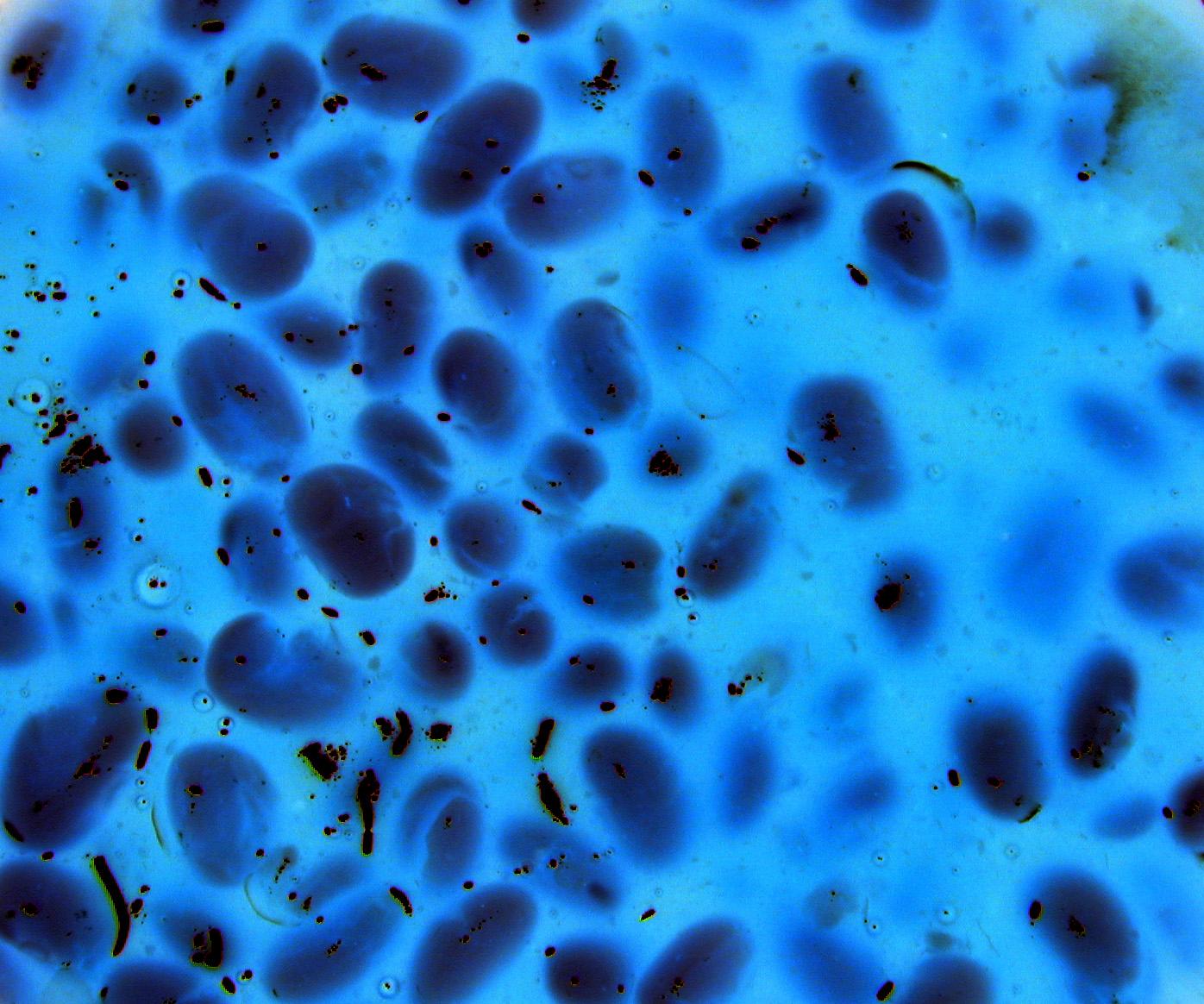 Magnification of a blue cell culture